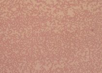 Barth Syndrome: Gene Therapy Offers Hope, But Challenges Remain for Rare Genetic Disorder Barth Syndrome: Gene Therapy Offers Hope, But Challenges Remain for Rare Genetic Disorder