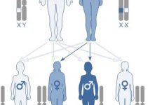 X-Linked Juvenile Retinoschisis Latest Facts: Etiology, Diagnosis and Treatment