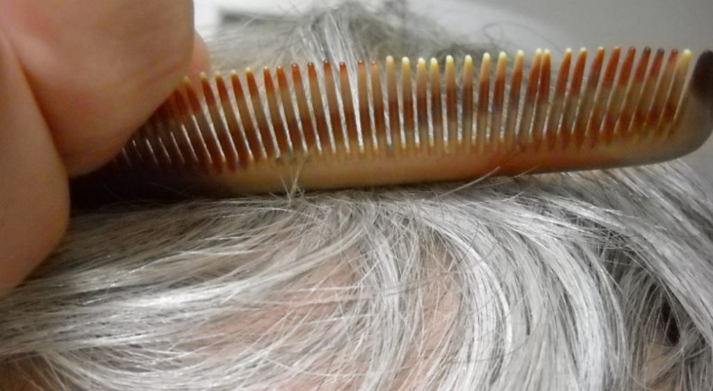 Apraxia Latest Facts Definition, Types, Causes and Treatments