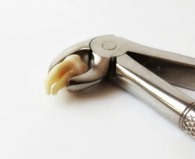 Dental Health Common Complications of Tooth Extractions and How to