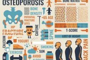 Osteoporosis Guide