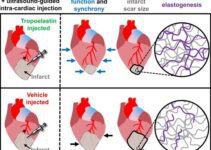 Heart Attack: Tropoelastin Restores Muscle Elasticity after a Myocardial Infarction Heart Attack: Tropoelastin Restores Muscle Elasticity after a Myocardial Infarction