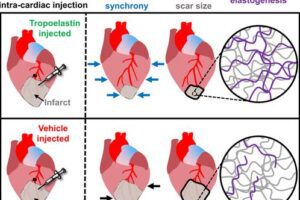 Heart Attack: Tropoelastin Restores Muscle Elasticity after a Myocardial Infarction