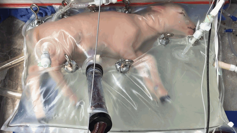 Artificial-Womb