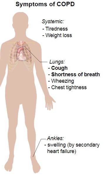 COPD Symptoms