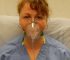 Resources and Support Materials for Individuals Living with COPD in Canada